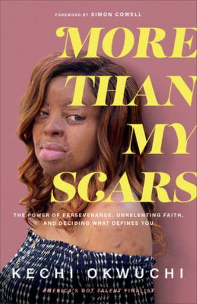 More Than My Scars - Kechi Okwuchi